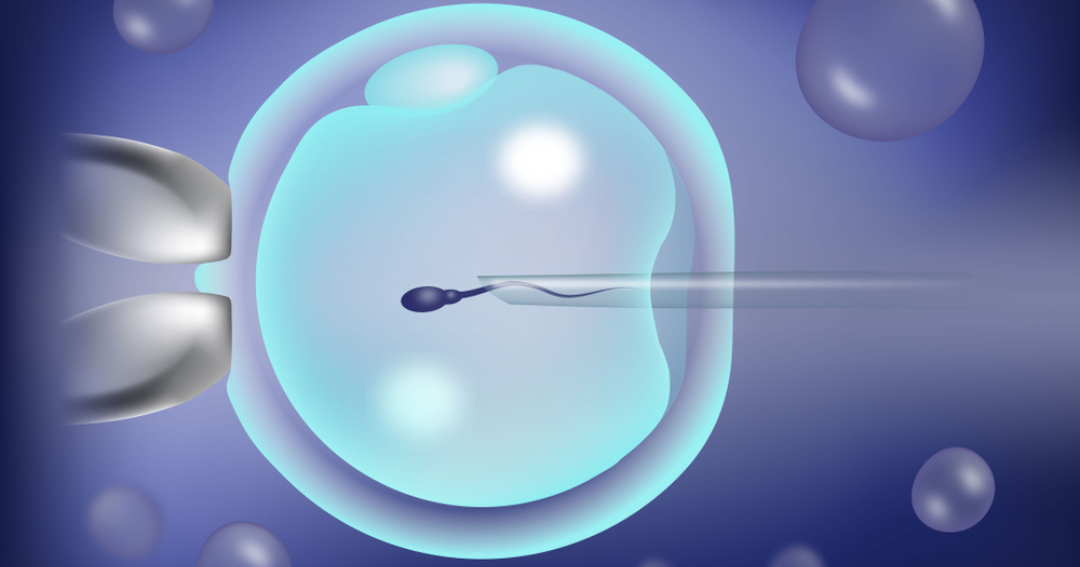 الحقن المجهرى كرمة كلينيك - د/أحمد محب